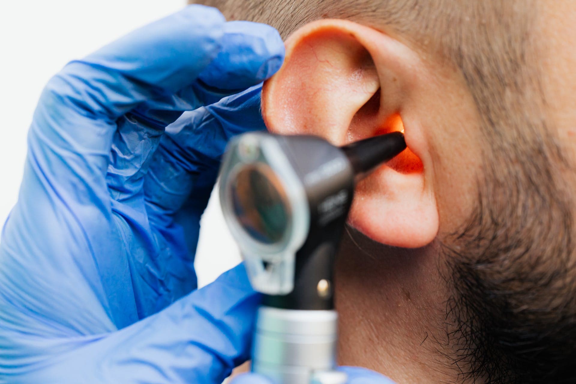 Millions in England Lose Access to Free NHS Earwax Removal Services, Prompting Concerns